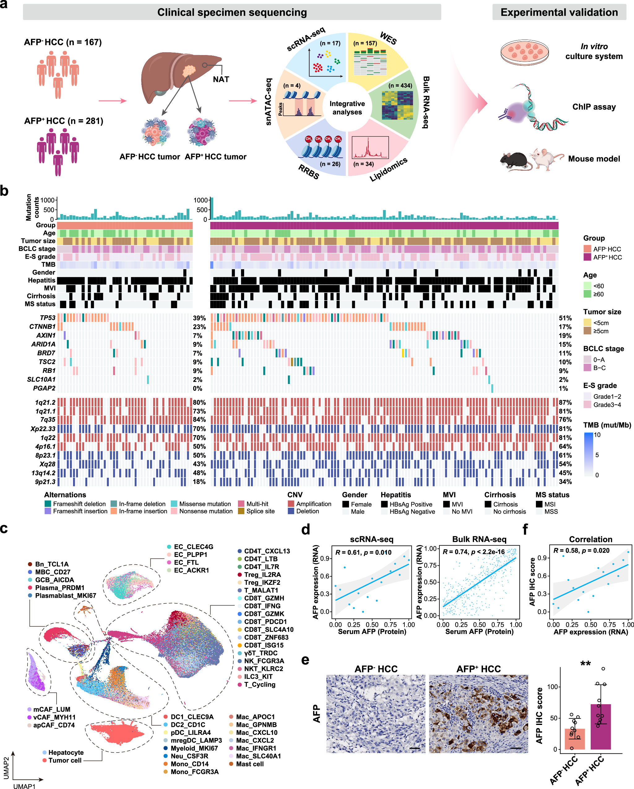 Androgen Receptor Promotes Arachidonic Acid Metabolism And Angiogenic Microenvironment In AFP negative Hepatocellular Carcinoma Nature Communications