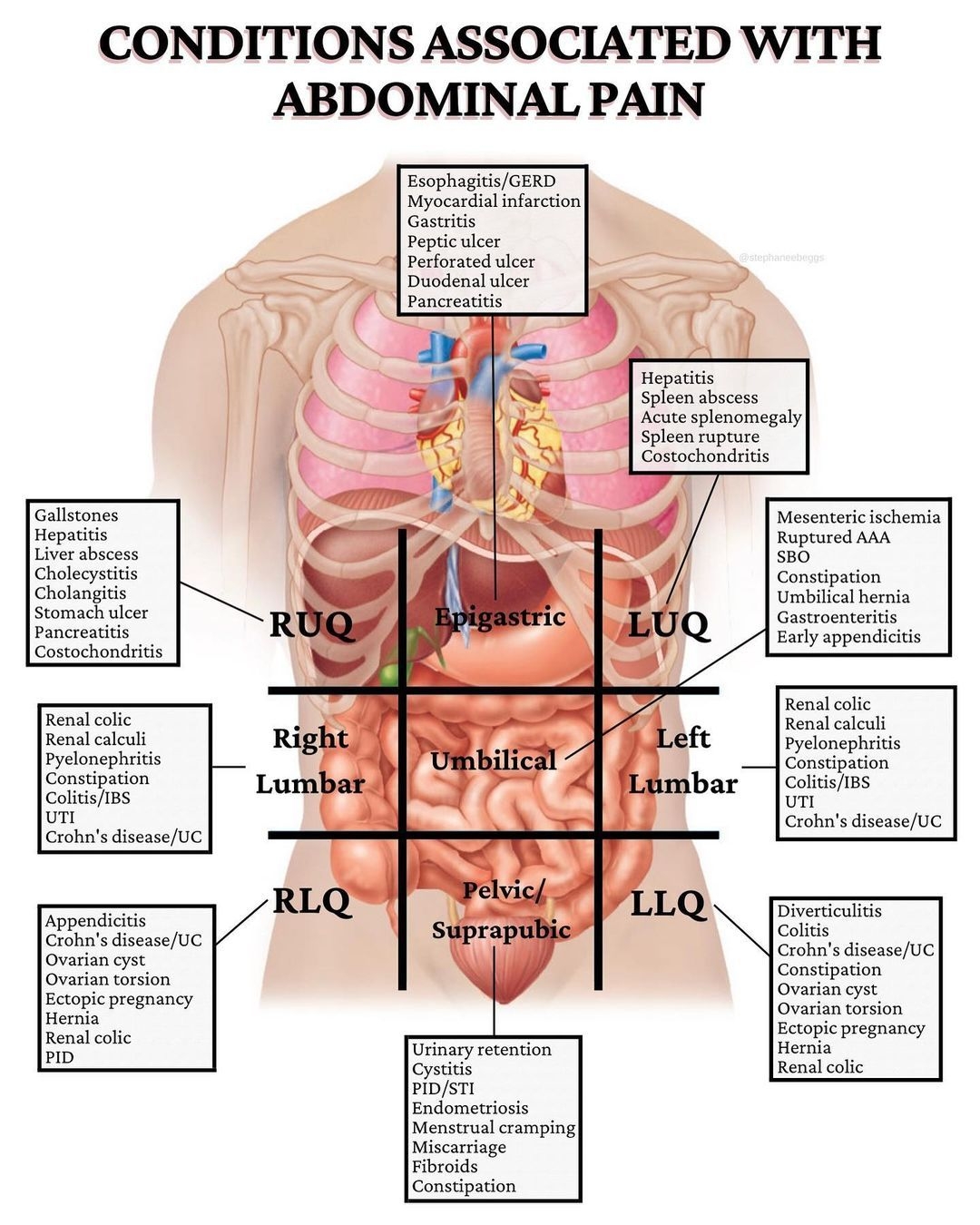 Four Abdominal Quadrants And Nine Abdominal Regions