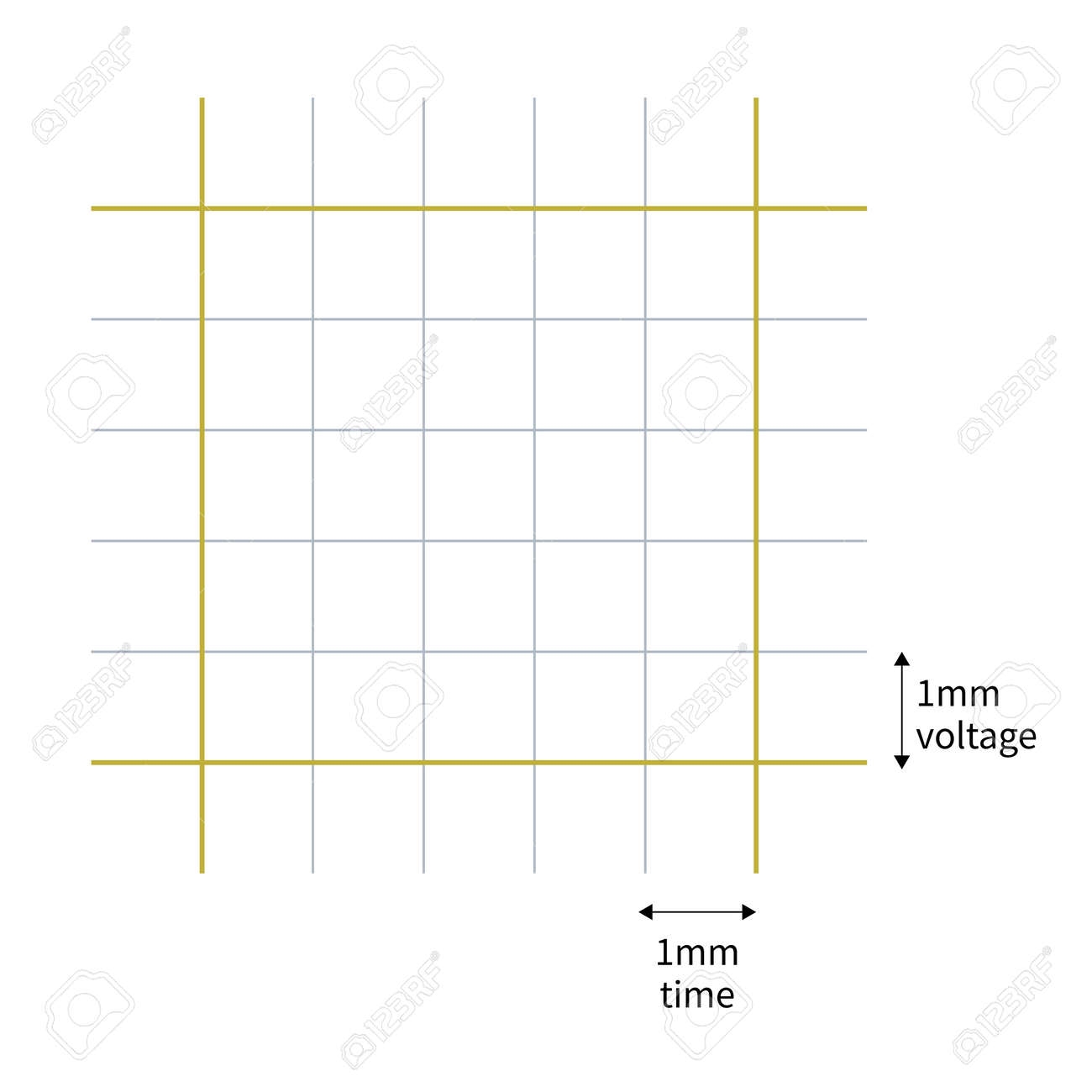 The ECG Paper Is Composed Of A Small Square With A Side Length Of 1mm The Abscissa Represents Time And The Ordinate Represents Amplitude Or Voltage Stock Photo Picture And Royalty Free